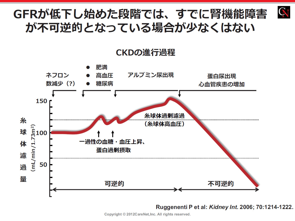 第2弾：かわるCKD診療、わかるCKD診療 2