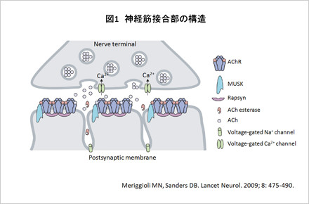 画像：重症筋無力症