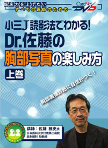 小三J読影法でわかる!Dr.佐藤の胸部写真の楽しみ方<上巻> 