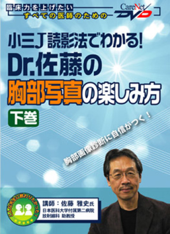 小三J読影法でわかる!Dr.佐藤の胸部写真の楽しみ方<下巻> 