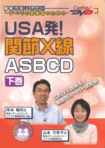 USA発!関節X線ASBCD<下巻>