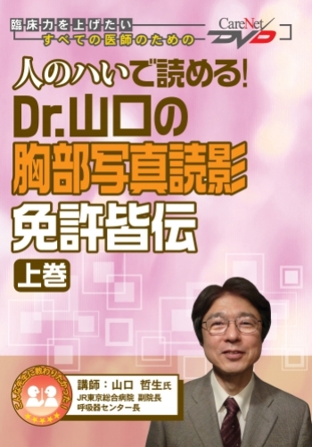 人のハいで読める ! Dr.山口の胸部写真読影 免許皆伝<上巻>