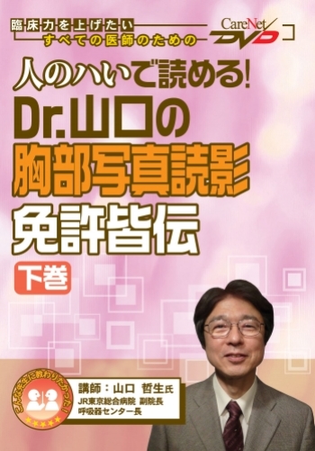 人のハいで読める ! Dr.山口の胸部写真読影 免許皆伝<下巻>