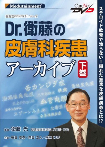 聖路加GENERAL【Dr.衛藤の皮膚科疾患アーカイブ】＜下巻＞