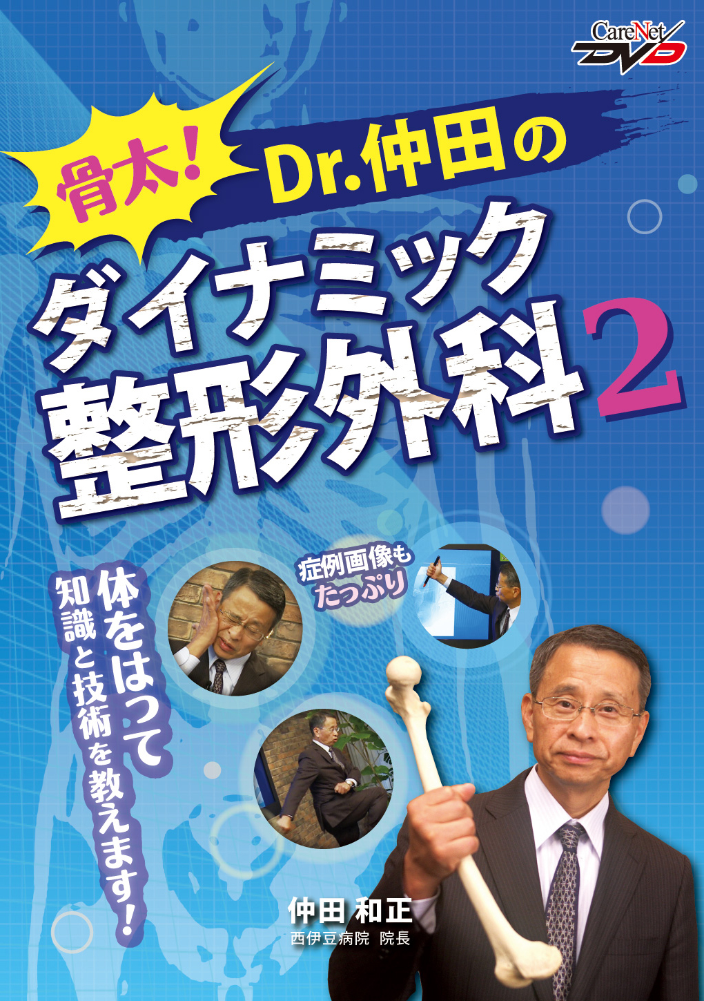 Dr.みやざきの鼠径ヘルニア手術テクニックコレクション /ケアネットDVD [DVD-ROM] 宮崎　恭介