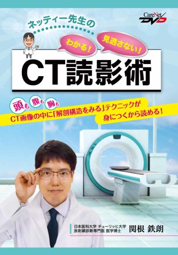 ネッティー先生のわかる！見逃さない！CT読影術