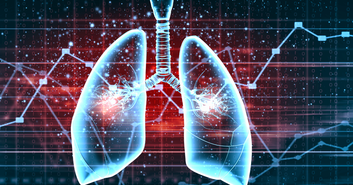 NSCLC1次治療、ペムブロリズマブへのイピリムマブ上乗せは効果示せず／JCO｜医師向け医療ニュースはケアネット