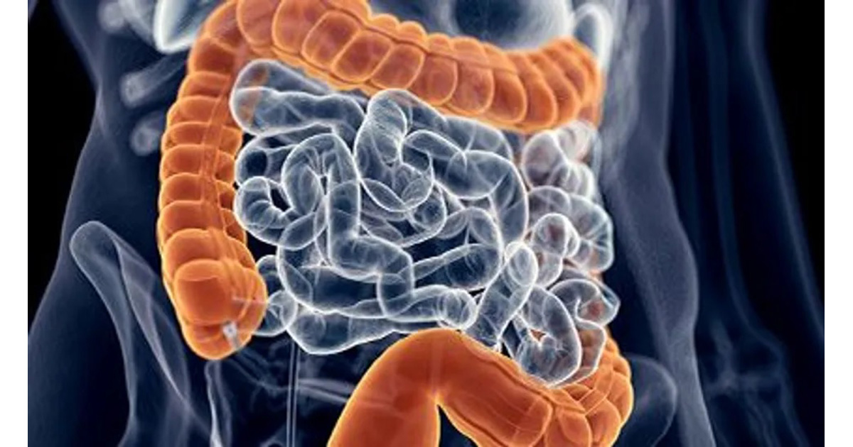 大腸内視鏡検査の精度を高めるAIツールを米FDAが承認