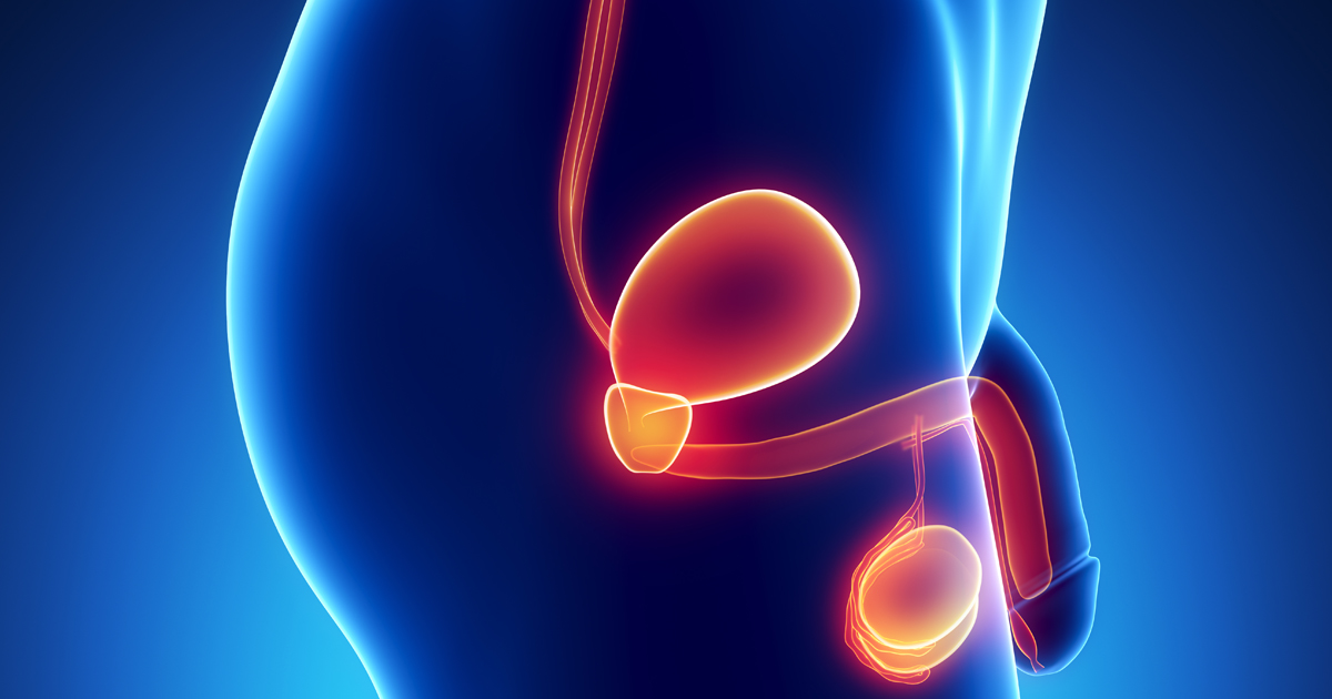 前立腺がんスクリーニング、MRI標的生検で過剰診断が低下/NEJM