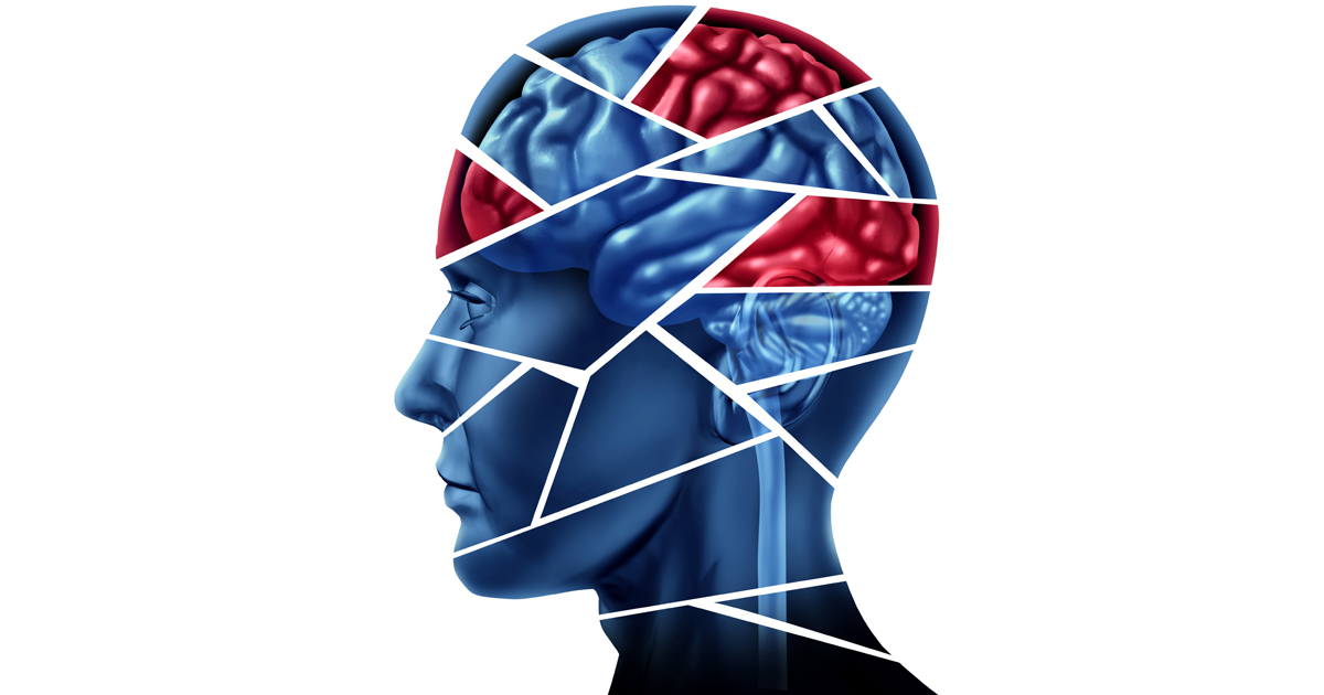 認知症関連精神症状、pimavanserinで再発リスク低下/NEJM