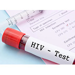 HIVに対するmRNAワクチン、動物実験で有望な結果