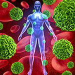CAR-T療法イエスカルタ、大細胞型B細胞リンパ腫の2次治療に有効  ／NEJM