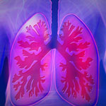 StageIAのNSCLC、区域切除が肺葉切除より優れる／Lancet