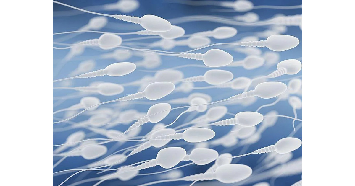 減量により肥満男性の精子数が上昇