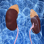 ニボルマブ＋イピリムマブによる腎がんアジュバントの成績（CheckMate -914）／BMS