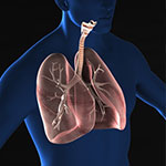 HER2変異非小細胞肺がんへのトラスツズマブ デルクステカン、FDAが迅速承認