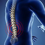 ウパダシチニブ、体軸性脊椎関節炎の症状を改善／Lancet