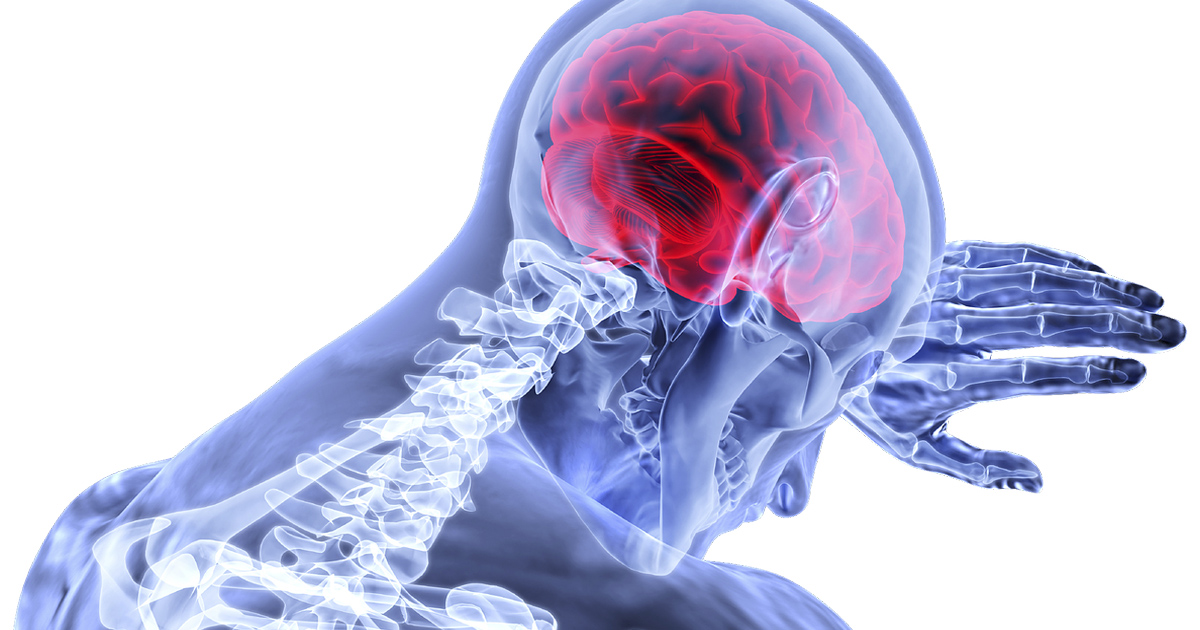 重度頭蓋内アテローム性動脈硬化による脳卒中、薬物+PTA/ステントは支持されず/JAMA