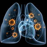 AmoyDx肺癌マルチ遺伝子PCRパネル、KRAS G12C変異肺がんのコンパニオン診断薬として承認／理研ジェネシス