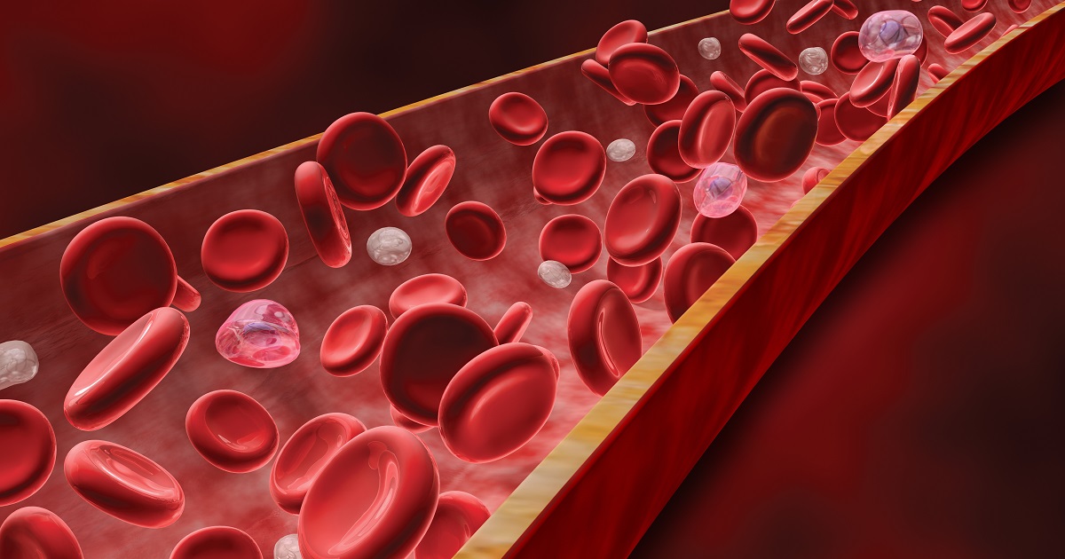 血友病Aの新規治療薬、既治療重症例の出血を低減／NEJM