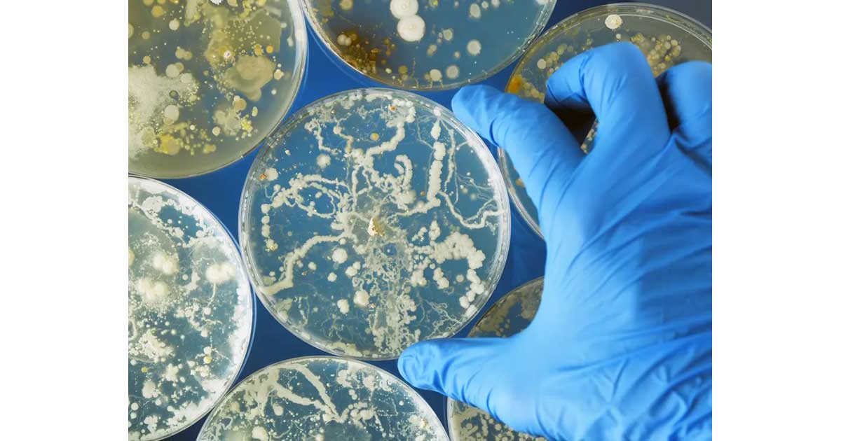 カンジダ・オーリス：真菌は耐性感染症を引き起こす