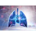早期に禁煙していた人は肺がんになっても死亡リスクが低い