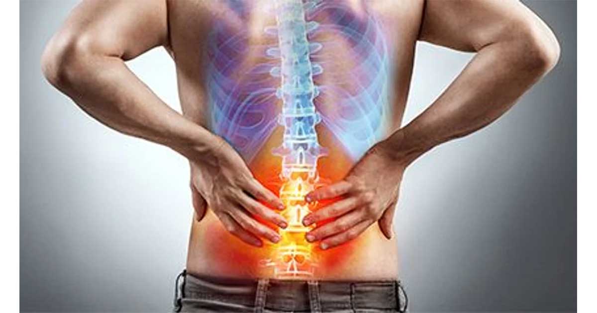 椎間板ヘルニアによる坐骨神経痛にはパルス高周波とステロイド注射の併用が有効
