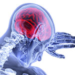 急性脳梗塞、血管内治療後の積極降圧は有益か？（BEST-II）／JAMA