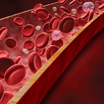エフガルチギモド、一次性免疫性血小板減少症に有効／Lancet