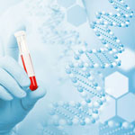 多がん早期検出血液検査は、がんスクリーニングで実行可能か／Lancet