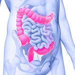 大腸がんの新しい非侵襲的検査、便潜血より良好な検出感度／JAMAのイメージ
