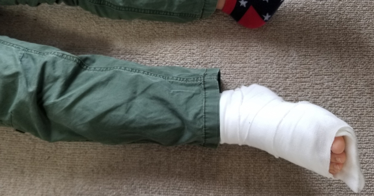 下肢外傷固定後の抗凝固療法、TRiP（cast）で必要性を判断可／Lancet｜医師向け医療ニュースはケアネット