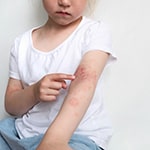 アトピー性皮膚炎は小児の学習・記憶に影響するか？