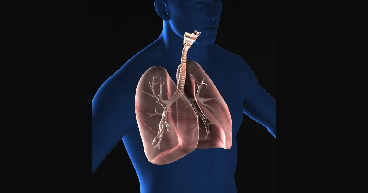 肺がん化学放射線療法の症例データベース検索システムを共同開発／富士フイルム・AZ