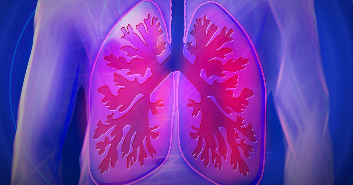 アレクチニブによるALK陽性肺がん術後補助療法をFDAが承認／中外
