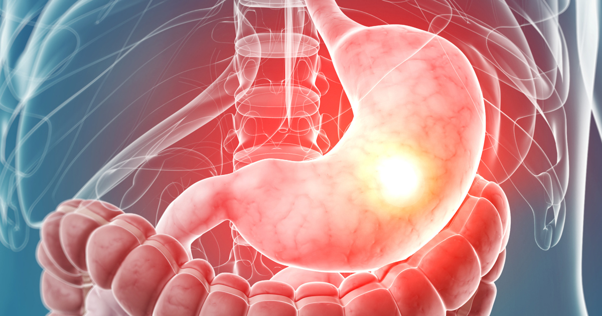 消化器外科: 食道胃接合部癌診療のすべて (06号)
