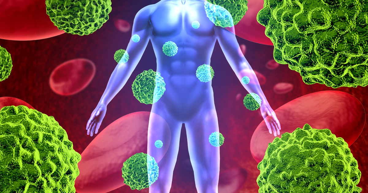 進行肛門扁平上皮がん、標準治療vs. retifanlimab上乗せ／Lancet