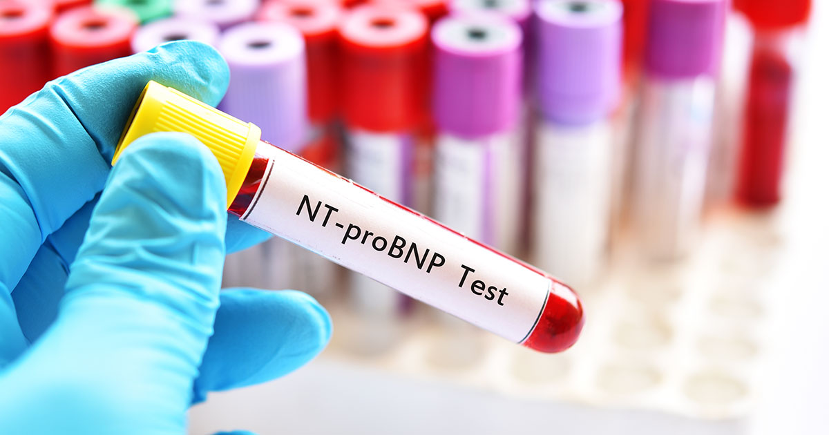 僧帽弁逆流症、MTEER後の予後予測にNT-proBNPが有用