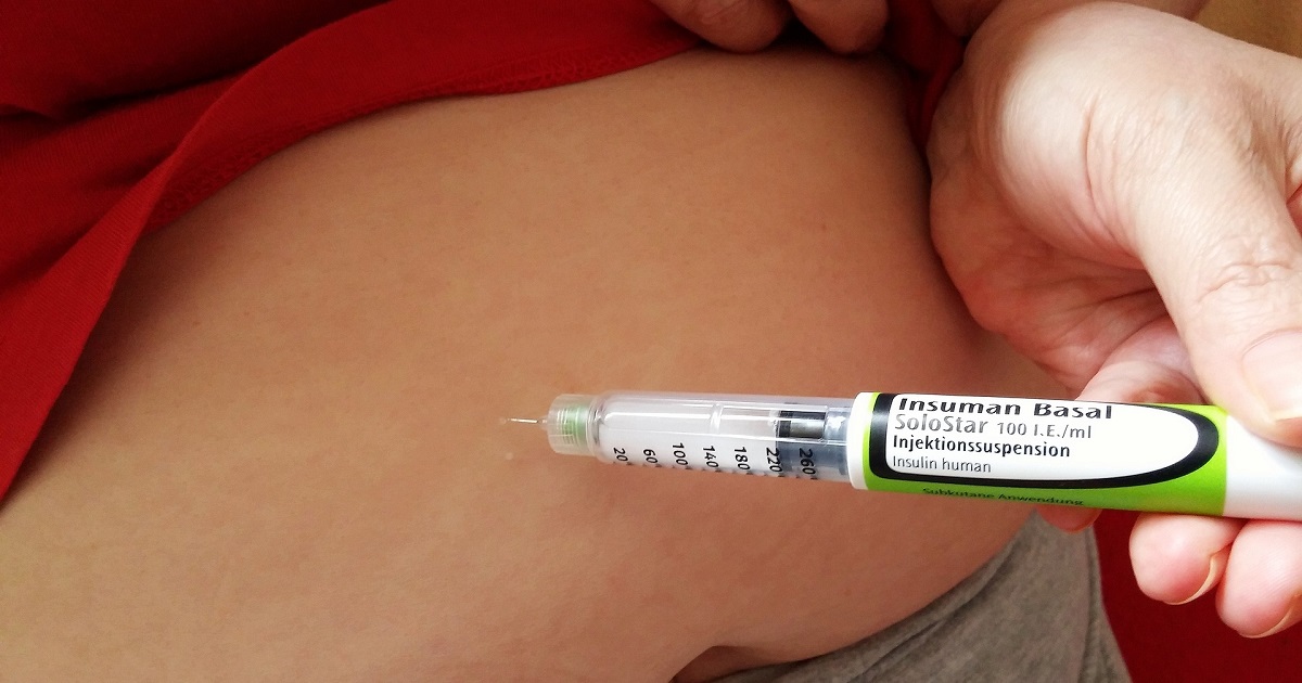基礎インスリン治療中の2型糖尿病、efsitoraはデグルデクに非劣性／Lancet