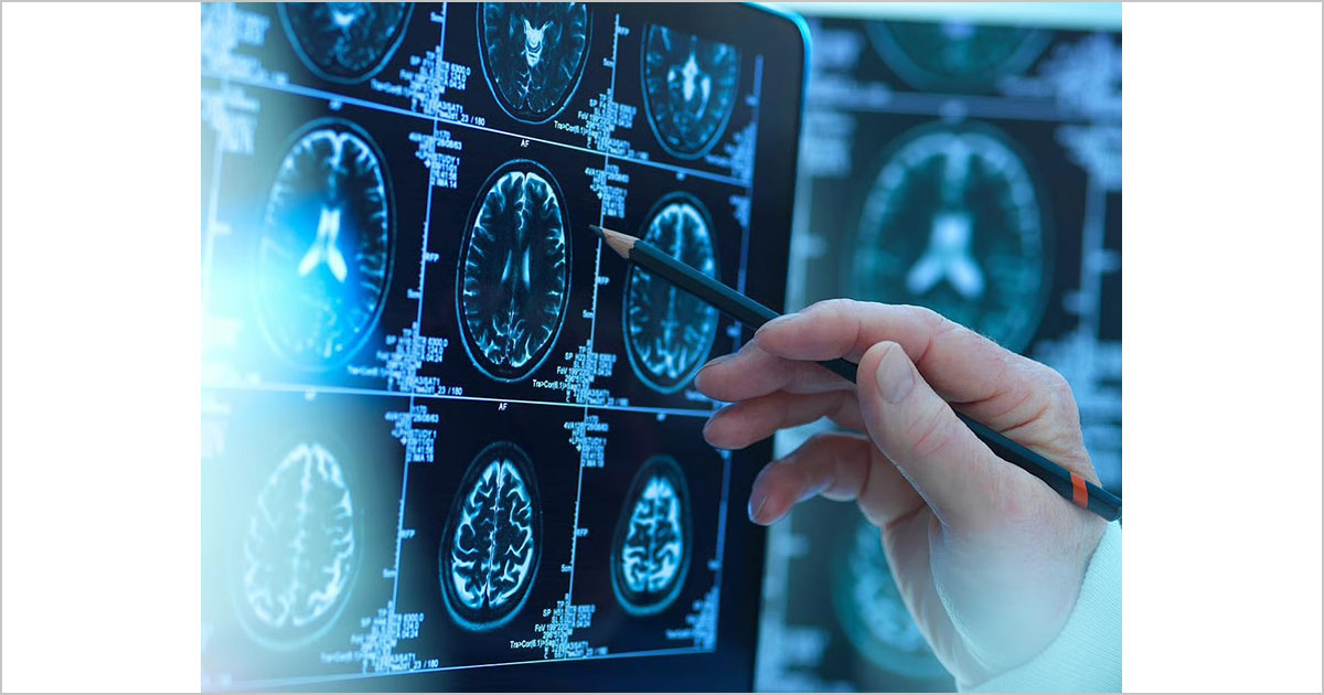 若々しい脳を保つ秘訣は筋肉量の維持と脂肪のカット