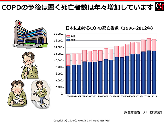 COPDの予後のイメージ