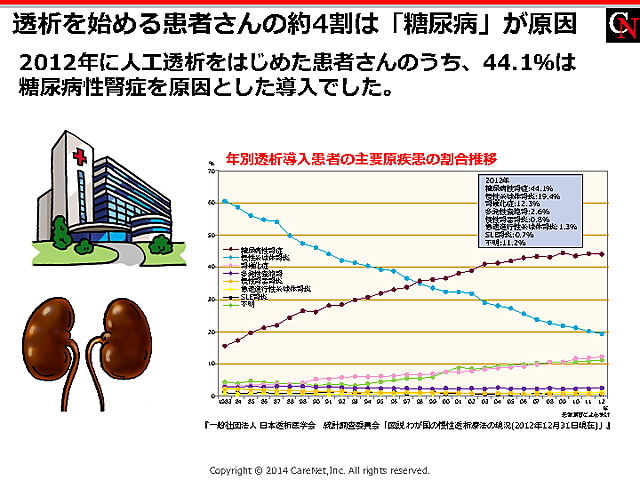 透析原因の4割は糖尿病のイメージ