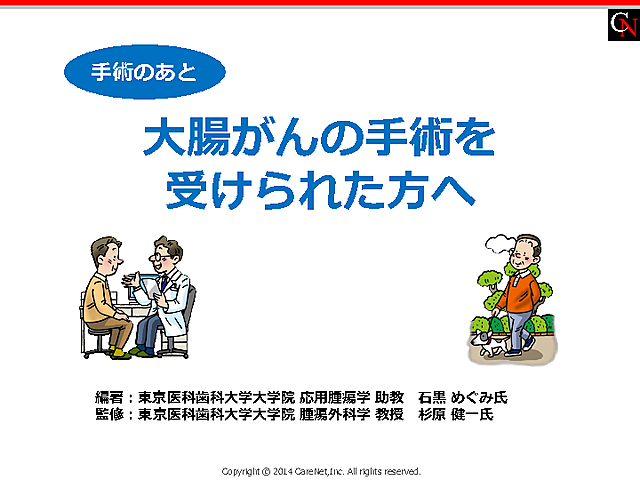 大腸がん手術後の患者さんへの説明のイメージ