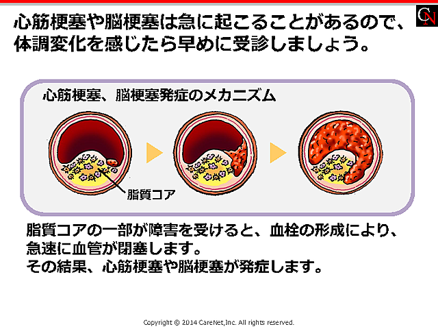 体調変化は早めに連絡のイメージ