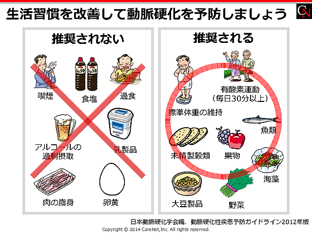 動脈硬化予防の食事のイメージ