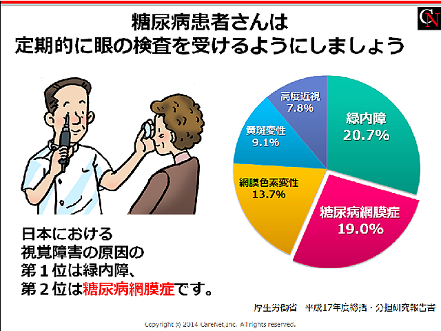 糖尿病から眼を守るのイメージ