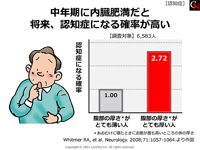 内臓肥満と認知症リスクのイメージ