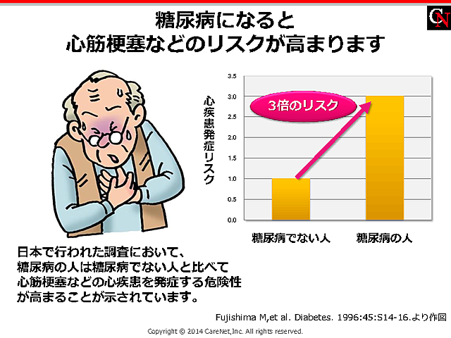 糖尿病＝心筋梗塞リスク↑のイメージ