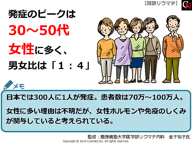 30～50代の女性に多いリウマチのイメージ