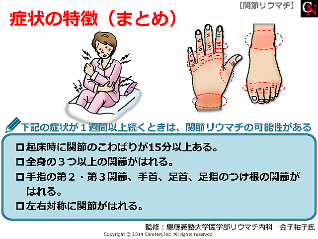 リウマチの可能性のある症状（まとめ）のイメージ